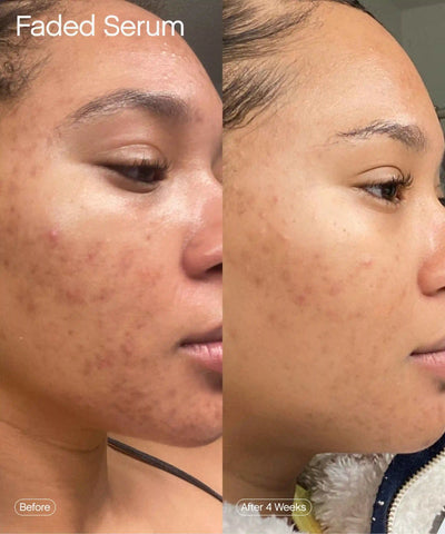 Faded Serum (Original Formula)