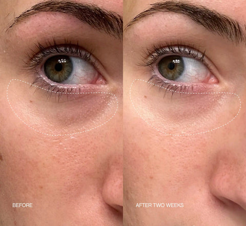 Faded Eye Masks: Collector's Pack
